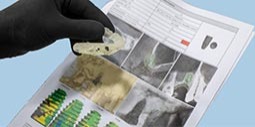 https://www.dentosophy.it/wp-content/uploads/2021/01/5f4e0f383808f_casi-clinici-implantologia.jpg
