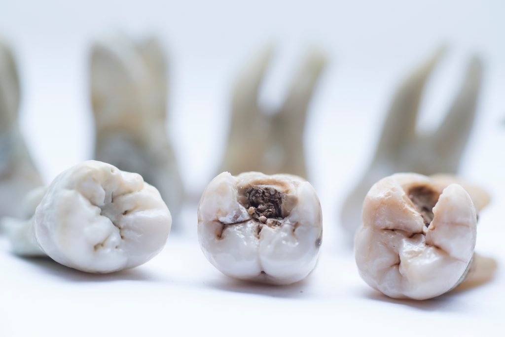 endodonzia https://www.dentosophy.it/wp-content/uploads/2021/01/endodonzia.jpg