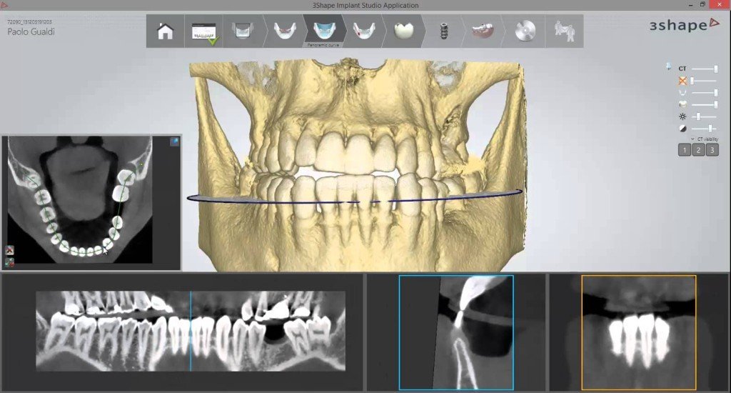 mascella-3D-1024x550 https://www.dentosophy.it/wp-content/uploads/2021/01/mascella-3D-1024x550-1.jpg